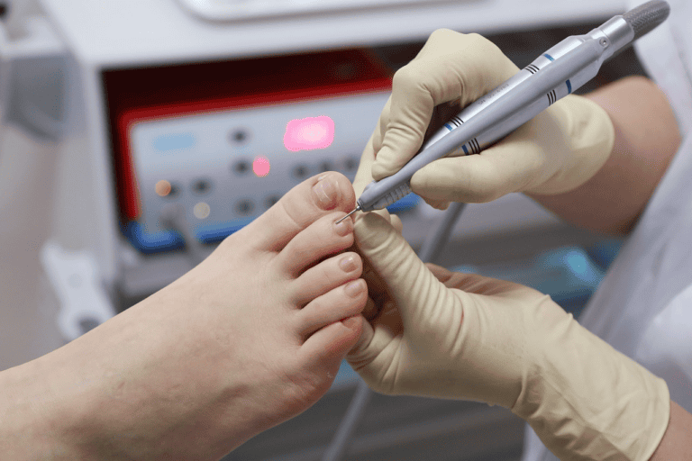 Needle on toenail