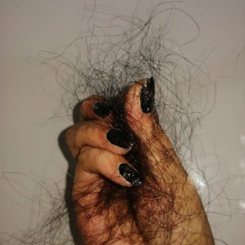 A hand of a woman holding hair strands due to a hair fall