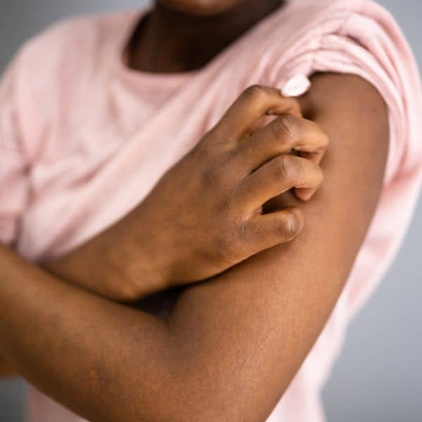 Woman scratching itchy arms